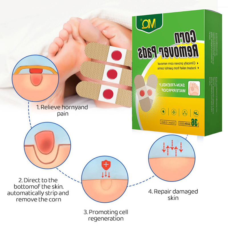 36개입 발 관리 스티커, 굳은살 제거 패치, 치료용  - Detox Foot Patch 리뷰 및 가격
